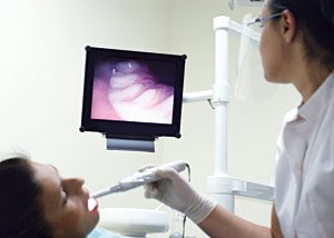 Intra-Oral Camera Image